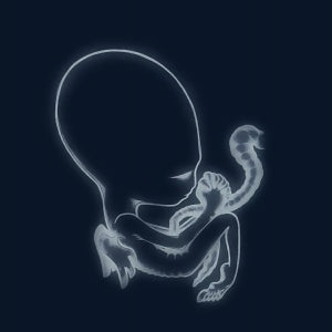 Sigur Rós – Ágætis Byrjun  2 x Vinyle, LP, Album, Réédition